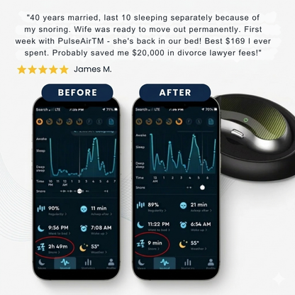 NeuroAir™ |  Smart Anti-Snoring Neurostimulation Device